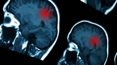 Lux Medica Neurolog Aleksandra Jarząbek-Stępniak Sosnowiec